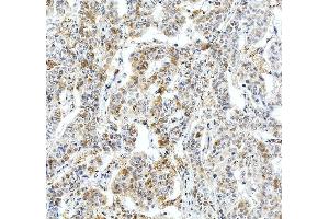 IHC analysis of Fibrinogen Beta Chain/FGB using anti-Fibrinogen Beta Chain/FGB antibody (ABIN4886579). (Fibrinogen beta Chain Antikörper  (Middle Region))
