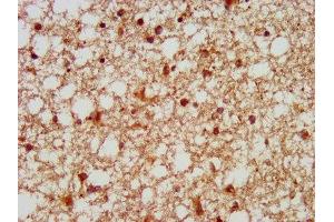 IHC image of ABIN7153781 diluted at 1:100 and staining in paraffin-embedded human brain tissue performed on a Leica BondTM system. (GTF3C5 Antikörper  (AA 305-448))
