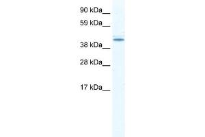 DDX49 antibody used at 2. (DDX49 Antikörper)