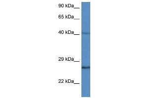 WB Suggested Anti-CCS AntibodyTitration: 1. (Superoxide dismutase copper chaperone Antikörper  (C-Term))
