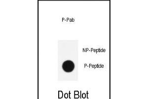 Dot blot analysis of anti-Phospho-KLF4- Antibody (ABIN390035 and ABIN2839785) on nitrocellulose membrane. (KLF4 Antikörper  (pSer254))