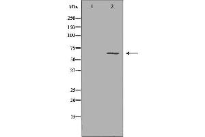 Western blot analysis of Hepg2 whole cell lysates, using CES1 Antibody.