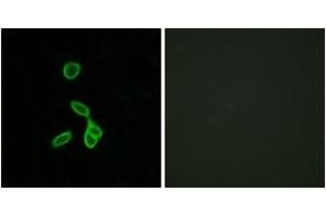 Immunofluorescence analysis of LOVO cells, using GALR1 Antibody. (Galanin Receptor 1 Antikörper  (AA 161-210))