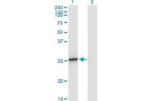 Western Blot analysis of AMELX expression in transfected 293T cell line by AMELX monoclonal antibody (M02A), clone 5B2. (AMELX Antikörper  (AA 93-191))