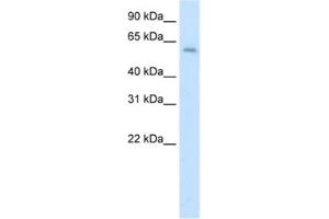 Western Blotting (WB) image for anti-Apoptosis Antagonizing Transcription Factor (AATF) antibody (ABIN2461824) (AATF Antikörper)