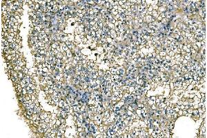 IHC analysis of NEDD4 using anti-NEDD4 antibody (ABIN7599536).