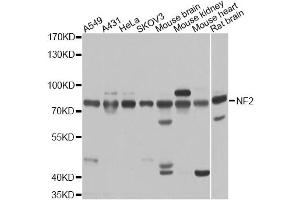 Western blot analysis of extracts of various cell lines, using NF2 antibody. (Merlin Antikörper)