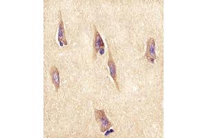 Immunohistochemistry (Paraffin-embedded Sections) (IHC (p)) image for anti-Neuronal Pentraxin 1 (NPX1) (AA 322-350) antibody (ABIN652309)