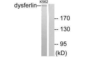 Western blot analysis of extracts from K562 cells, using Dysferlin antibody. (Dysferlin Antikörper)