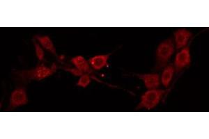 ABIN6272389 staining HuvEc by IF/ICC. (OLFML2B Antikörper  (Internal Region))