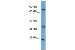 WB Suggested Anti-ABCD2 Antibody Titration: 0. (CCL17 Antikörper  (N-Term))