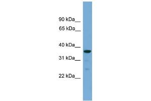 WB Suggested Anti-HAPLN2 Antibody Titration: 0. (HAPLN2 Antikörper  (Middle Region))