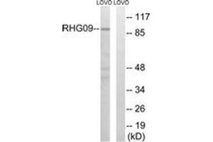 Western Blotting (WB) image for anti-rho GTPase Activating Protein 9 (ARHGAP9) (AA 220-269) antibody (ABIN2890586) (ARHGAP9 Antikörper  (AA 220-269))
