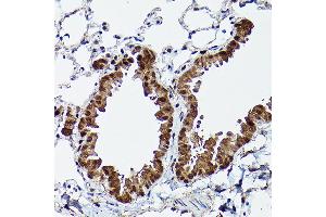 Immunohistochemistry (IHC) image for anti-Mitogen-Activated Protein Kinase 7 (MAPK7) (AA 1-310) antibody (ABIN3022945)