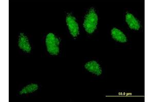Immunofluorescence of monoclonal antibody to CYLD on HeLa cell. (CYLD Antikörper  (AA 854-953))