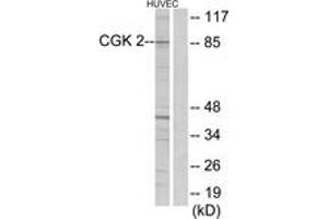 Western blot analysis of extracts from HuvEc cells, using CGK 2 Antibody. (PRKG2 Antikörper  (AA 391-440))