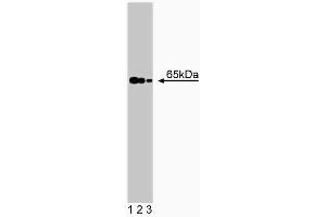 Western blot analysis of NMT-2 on human endothelial lysate. (NMT2 Antikörper  (AA 10-119))