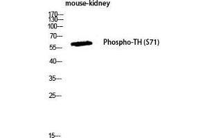 Western Blot (WB) analysis of Mouse Kidney lysis using Phospho-TH (S71) antibody. (TH Antikörper  (pSer71))