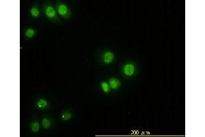 Immunofluorescence of monoclonal antibody to STK38 on HeLa cell. (STK38 Antikörper  (AA 1-465))