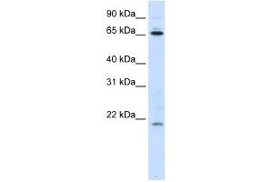 WB Suggested Anti-NIP7 Antibody Titration:  0. (NIP7 Antikörper  (Middle Region))