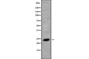 Western blot analysis of RAB8B using HeLa whole cell lysates (RAB8B Antikörper  (C-Term))