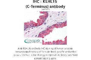 Image no. 1 for anti-Kelch-Like 15 (KLHL15) (C-Term) antibody (ABIN1736246) (KLHL15 Antikörper  (C-Term))