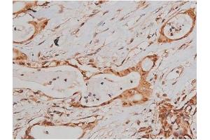 ABIN6267363 at 1/200 staining Human prostate tissue sections by IHC-P.