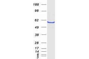 Western Blotting (WB) image for Cytochrome P450, Family 46, Subfamily A, Polypeptide 1 (CYP46A1) protein (Myc-DYKDDDDK Tag) (ABIN2712777)