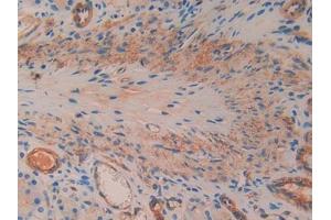 DAB staining on IHC-P; Samples: Rat Stomach Tissue (SMAD1 Antikörper  (AA 273-468))