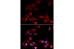 Immunofluorescence analysis of U2OS cells using APBB1 antibody (ABIN5971004).
