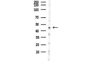 anti-Chemokine (C-X-C Motif) Receptor 6 (CXCR6) (C-Term) antibody