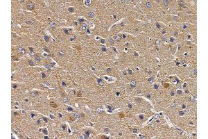 ABIN6258265 and ABIN6273489 at 1/100 staining rat brain tissue by IHC-P.