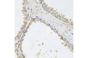 Immunohistochemistry of paraffin-embedded human prostate using POMGNT1 antibody. (POMGNT1 Antikörper)