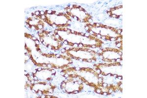Immunohistochemistry (IHC) image for anti-Tumor Necrosis Factor Receptor Superfamily, Member 10d, Decoy with Truncated Death Domain (TNFRSF10D) (AA 257-386) antibody (ABIN6149306)