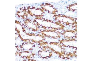 Immunohistochemistry of paraffin-embedded mouse kidney using TNFRSF10D Rabbit pAb (ABIN6127587, ABIN6149306, ABIN6149308 and ABIN6221737) at dilution of 1:100 (40x lens). (DcR2 Antikörper  (AA 257-386))