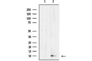 anti-High Mobility Group Nucleosomal Binding Domain 2 (HMGN2) (Internal Region) antibody