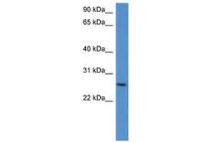 Image no. 1 for anti-Chondrolectin (CHODL) (AA 161-210) antibody (ABIN6746374) (CHODL Antikörper  (AA 161-210))