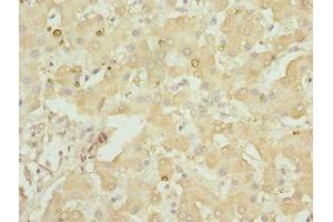 Immunohistochemistry of paraffin-embedded human liver tissue using ABIN7154146 at dilution of 1:100 (GLYCTK Antikörper  (AA 284-523))