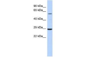 LPCAT1 antibody used at 1 ug/ml to detect target protein.