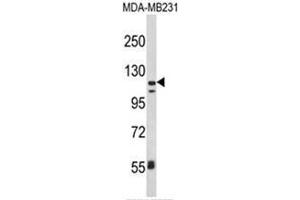 Western blot analysis of ITGAX Antibody (C-term) in MDA-MB231 cell line lysates (35ug/lane). (CD11c Antikörper  (C-Term))