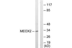 Western blot analysis of extracts from COLO205 cells, using MEOX2 antibody. (MEOX2 Antikörper  (Internal Region))