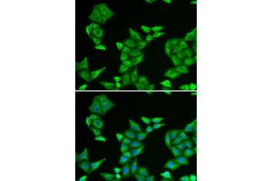 Immunofluorescence analysis of HeLa cells using COX5A antibody (ABIN5973837). (COX5A Antikörper)