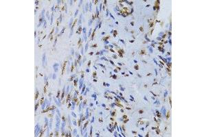 Immunohistochemistry (Paraffin-embedded Sections) (IHC (p)) image for anti-X-Ray Repair Complementing Defective Repair in Chinese Hamster Cells 5 (Double-Strand-Break Rejoining) (XRCC5) (AA 543-732) antibody (ABIN6150309)