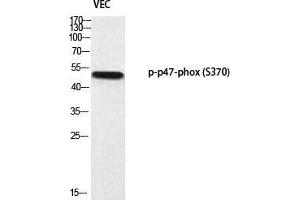 Western Blot (WB) analysis of VEC using p-p47-phox (S370) antibody. (NCF1 Antikörper  (pSer370))