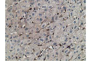 Immunohistochemical staining of paraffin-embedded Human liver tissue using anti-RBP1 mouse monoclonal antibody. (RBP1 Antikörper)