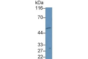 Detection of b4GALNT2 in Hela cell lysate using Monoclonal Antibody to Beta-1,4-N-Acetyl Galactosaminyl Transferase 2 (b4GALNT2) (B4GALNT2 Antikörper  (AA 324-566))