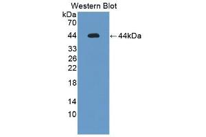 Detection of Recombinant IL12Rb1, Mouse using Polyclonal Antibody to Interleukin 12 Receptor Beta 1 (IL12Rb1) (IL12RB1 Antikörper  (AA 197-348))