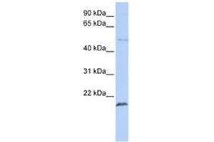 Image no. 1 for anti-Zinc Finger Protein 79 (ZNF79) (N-Term) antibody (ABIN6740442) (ZNF79 Antikörper  (N-Term))