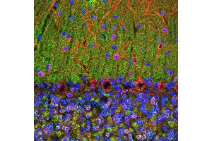 Confocal image of adult rat cerebellum stained with VILIP / VSNL1 antibody (green), chicken polyclonal antibody to MAP2(red) and DNA (blue). (VSNL1 Antikörper)