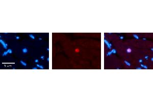 Rabbit Anti-RING1 Antibody Catalog Number: ARP33228_P050 Formalin Fixed Paraffin Embedded Tissue: Human heart Tissue Observed Staining: Nucleus Primary Antibody Concentration: 1:100 Other Working Concentrations: N/A Secondary Antibody: Donkey anti-Rabbit-Cy3 Secondary Antibody Concentration: 1:200 Magnification: 20X Exposure Time: 0. (RING1 Antikörper  (Middle Region))
